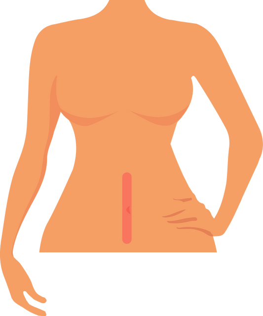 Línea de Abdomen